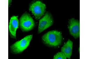 HUVEC cells were stained with Estrogen Receptor alpha(S118) (3A7) Monoclonal Antibody  at [1:200] incubated overnight at 4C, followed by secondary antibody incubation, DAPI staining of the nuclei and detection. (Estrogen Receptor alpha antibody  (pSer118))