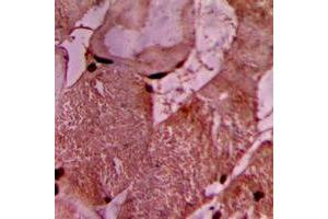 Immunohistochemical analysis of Vinculin staining in human heart formalin fixed paraffin embedded tissue section. (Vinculin antibody  (Center))