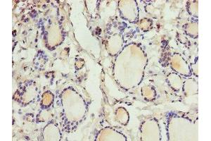 Immunohistochemistry of paraffin-embedded human thyroid tissue using ABIN7147338 at dilution of 1:100 (CRABP1 antibody  (AA 2-137))