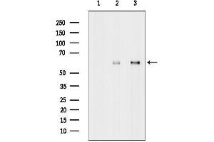 Western blot analysis of lysates from various samples, using MAGE2 Antibody.
