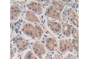 Used in DAB staining on fromalin fixed paraffin- embedded stomach tissue (ABCF1 antibody  (AA 625-845))