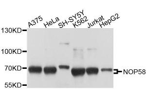 Western blot analysis of extracts of various cell lines, using NOP58 antibody. (NOP58 antibody  (AA 360-529))