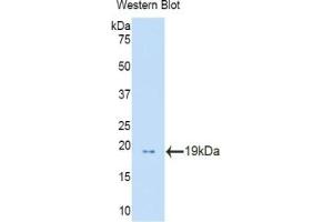Detection of Recombinant PFN1, Human using Polyclonal Antibody to Profilin 1 (PFN1) (PFN1 antibody  (AA 1-139))