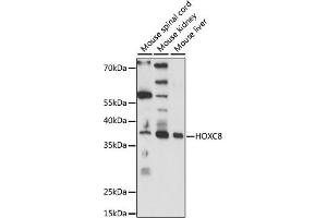 Western blot analysis of extracts of various cell lines, using HOXC8 antibody (ABIN7267773) at 1:1000 dilution. (HOXC8 antibody  (AA 1-150))