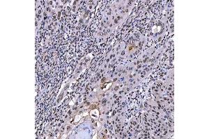 IHC analysis of SAE1 using anti-SAE1 antibody (ABIN7601346). (SAE1 antibody  (AA 33-299))