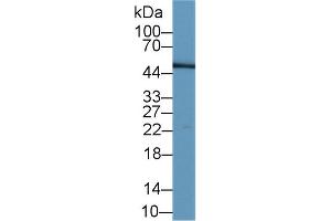 Detection of LRG1 in Human Serum using Monoclonal Antibody to Leucine Rich Alpha-2-Glycoprotein 1 (LRG1) (LRG1 antibody  (AA 37-340))