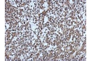 IHC-P Image Immunohistochemical analysis of paraffin-embedded 59T xenograft, using MDC1, antibody at 1:500 dilution. (MDC1 antibody)