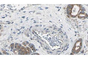 ABIN6275049 at 1/100 staining Human prostate tissue by IHC-P.