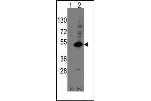 Image no. 1 for anti-Nuclear Receptor Subfamily 0, Group B, Member 1 (NR0B1) (C-Term) antibody (ABIN357834) (NR0B1 antibody  (C-Term))