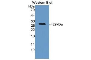 Western Blotting (WB) image for anti-Oxidized Low Density Lipoprotein (Lectin-Like) Receptor 1 (OLR1) antibody (ABIN1862864) (OLR1 antibody)