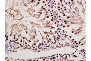 Formalin-fixed and paraffin embedded rat testis labeled with Rabbit Anti-MAP2(Ser136) Polyclonal Antibody, Unconjugated (ABIN743648) at 1:200 followed by conjugation to the secondary antibody and DAB staining