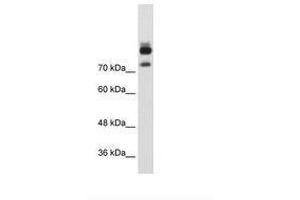 Image no. 1 for anti-Myotubularin Related Protein 1 (MTMR1) (AA 551-600) antibody (ABIN203423) (MTMR1 antibody  (AA 551-600))