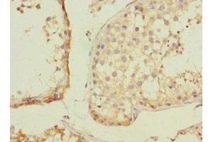 Immunohistochemistry of paraffin-embedded human testis tissue using ABIN7176401 at dilution of 1:100 (ZNF582 antibody  (AA 1-300))