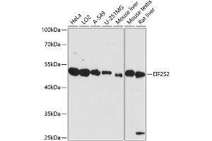Western blot analysis of extracts of various cell lines, using EIF2S2 antibody (ABIN7267033) at 1:3000 dilution. (EIF2S2 antibody  (AA 1-175))