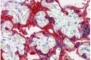 Immunohistochemistry (Formalin-fixed Paraffin-embedded Sections) (IHC (fp)) image for anti-Transglutaminase 2 (C Polypeptide, Protein-Glutamine-gamma-Glutamyltransferase) (TGM2) (AA 431-480) antibody (ABIN6747111)