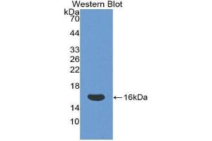 Western Blotting (WB) image for anti-CD160 (CD160) (AA 37-154) antibody (ABIN1858289) (CD160 antibody  (AA 37-154))