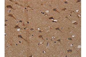 The image on the left is immunohistochemistry of paraffin-embedded Human brain tissue using ABIN7191822(PDE5A Antibody) at dilution 1/50, on the right is treated with synthetic peptide. (PDE5A antibody)