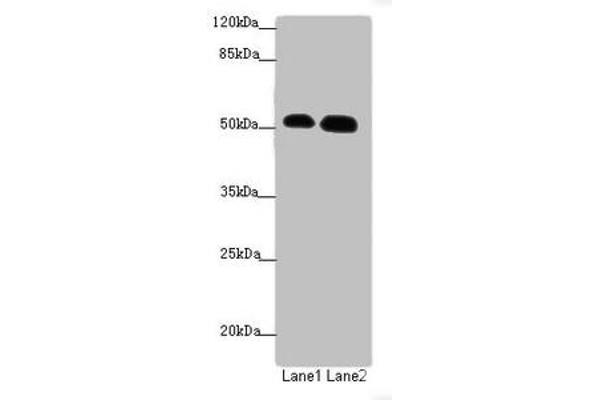 ATM Interactor antibody  (AA 160-360)