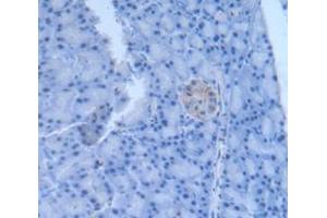 Figure. (LEFTY1 antibody  (AA 169-368))