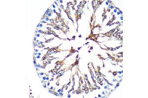 Immunohistochemistry of paraffin-embedded Rat testis using KIF17 Rabbit pAb (ABIN7268123) at dilution of 1:100 (40x lens). (KIF17 antibody  (AA 360-660))