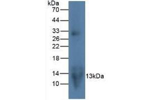 Detection of MIP3a in Rat Lymphocyte Cells using Monoclonal Antibody to Macrophage Inflammatory Protein 3 Alpha (MIP3a) (CCL20 antibody  (AA 24-95))