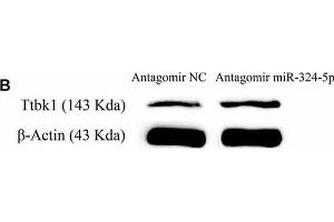 miRNA-324-5p acts onto Ttbk1 and downregulates Tau-tubulin kinase-1.