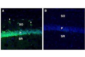 Expression of SORL1 in mouse hippocampus. (SORL1 antibody  (Extracellular, N-Term))