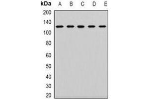 anti-Prominin 1 (PROM1) (N-Term) antibody