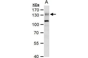 WB Image ENPP1 antibody [N2C2], Internal detects ENPP1 protein by western blot analysis. (ENPP1 antibody)