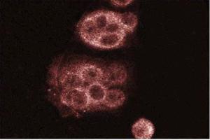 MCF7 (ROCK2 antibody  (AA 567-718))