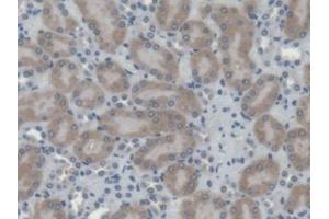 DAB staining on IHC-P; Samples: Mouse Kidney Tissue (Cathepsin H antibody  (AA 21-333))
