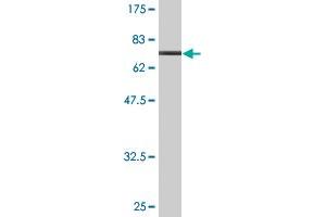 Western Blot detection against Immunogen (70. (PDK2 antibody  (AA 1-407))