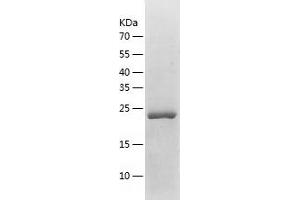 Western Blotting (WB) image for Cyclin-Dependent Kinase Inhibitor 3 (CDKN3) (AA 1-212) protein (His tag) (ABIN7287363) (CDKN3 Protein (AA 1-212) (His tag))