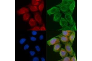 ABIN6258681 and ABIN6274241 staining Hela cells(45 min of heat-shock) by IF/ICC. (ACTN2/3 antibody  (N-Term))
