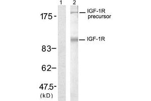 Western blot analysis of extract from 293 cells, using IGF-1R (Ab-1280) antibody (E021302, Lane 1 and 2). (IGF1R antibody)