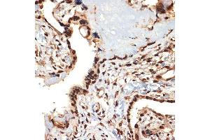 Immunohistochemistry of paraffin-embedded human placenta using CIRBP Rabbit mAb (ABIN7266452) at dilution of 1:100 (40x lens). (CIRBP antibody)