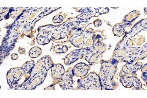 Detection of LIFR in Human Placenta Tissue using Polyclonal Antibody to Leukemia Inhibitory Factor Receptor (LIFR) (LIFR antibody  (AA 692-833))