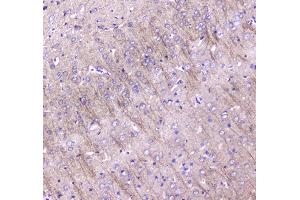 Immunohistochemistry (IHC) image for anti-Microtubule-Associated Protein 1 Light Chain 3 alpha (MAP1LC3A) (AA 1-120) antibody (ABIN5693061)