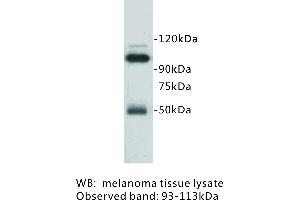 Image no. 1 for anti-Melanoma Cell Adhesion Molecule (MCAM) antibody (ABIN1112867)