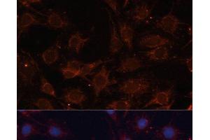 Immunofluorescence analysis of C6 cells using SLC25A24 Polyclonal Antibody at dilution of 1:100. (SLC25A24 antibody)