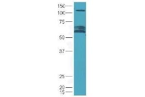 Lane 1: mouse brain lysates probed with Rabbit Anti-Chrm3 Polyclonal Antibody, Unconjugated  at 1:5000 for 90 min at 37˚C. (CHRM3 antibody  (AA 481-589))