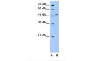 Image no. 1 for anti-Zona Pellucida Glycoprotein 4 (ZP4) (N-Term) antibody (ABIN6738590)