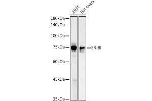 Western blot analysis of extracts of various cell lines, using SR-BI antibody (ABIN3022185, ABIN3022186, ABIN1513498 and ABIN6218655) at 1:1000 dilution. (SCARB1 antibody  (AA 1-100))