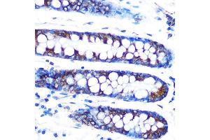 Immunohistochemistry of paraffin-embedded human colon using Lumican (LUM) (LUM) Rabbit mAb (ABIN7268309) at dilution of 1:100 (40x lens). (LUM antibody)