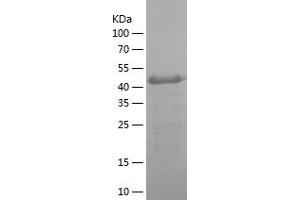 Western Blotting (WB) image for Carbonic Anhydrase IX (CA9) (AA 38-153) protein (His-IF2DI Tag) (ABIN7282075) (CA9 Protein (AA 38-153) (His-IF2DI Tag))