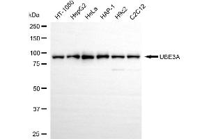 anti-Ubiquitin Protein Ligase E3A (ube3a) antibody