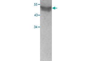 Western blot analysis of human fetal testis lysate with ESR2 polyclonal antibody  at 1 : 500 dilution. (ESR2 antibody  (N-Term))