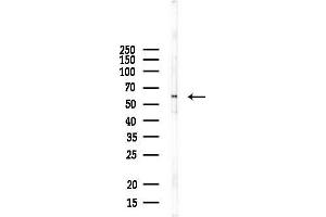 Western blot analysis of lysates from Mouse brain, using CHRNE Antibody at 1/1000 dilution.