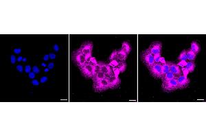 anti-Niemann-Pick Disease, Type C1 (NPC1) antibody