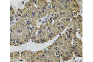 Immunohistochemistry of paraffin-embedded Human stomach using IL33 Polyclonal Antibody (IL-33 antibody)